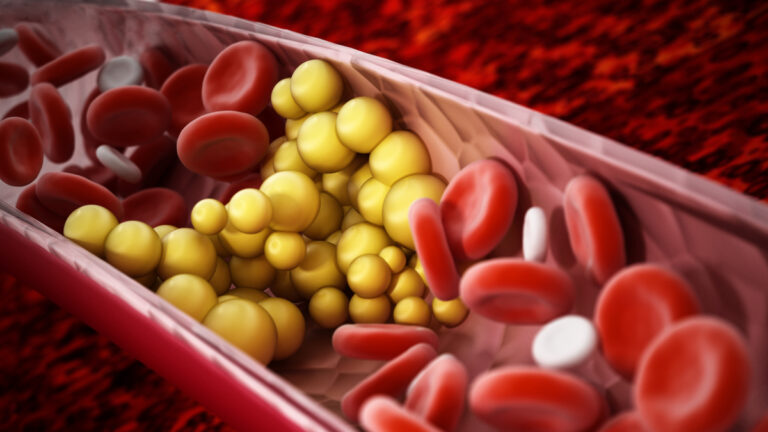 Estrategias para prevenir el exceso de colesterol en sangre